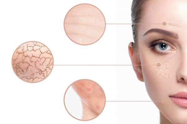 how-to-hydrate-your-skin